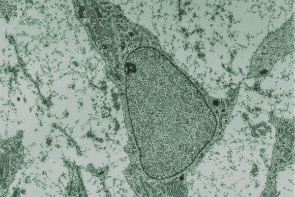MSC high magnification crp