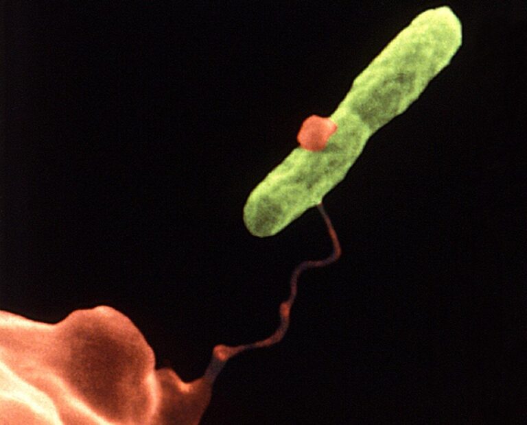 legionella cdc 768x620
