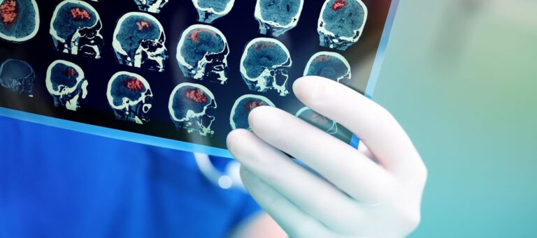 brain20tumours shutterstock 390249514 crop1 768x341