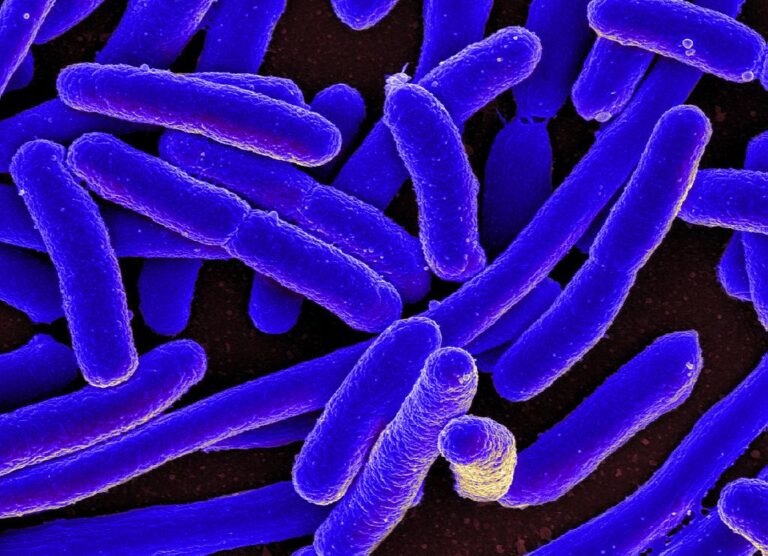 e coli bacteria1 768x556