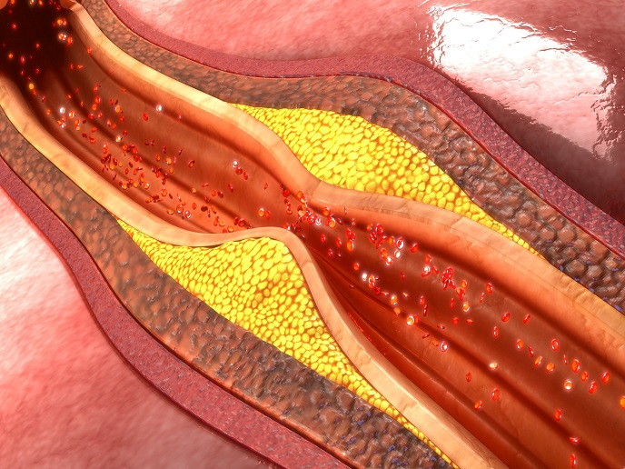 tmpop09sjra 1